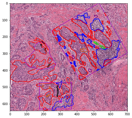 ../_images/examples_annotations_to_object_segmentation_masks_27_1.png