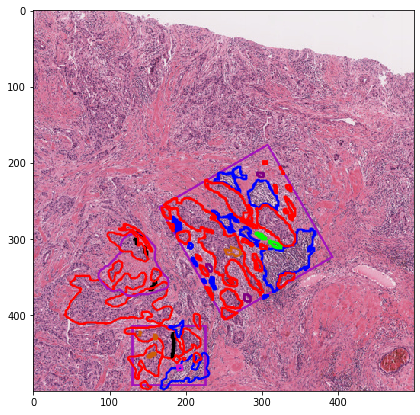 ../_images/examples_annotations_to_object_segmentation_masks_32_0.png