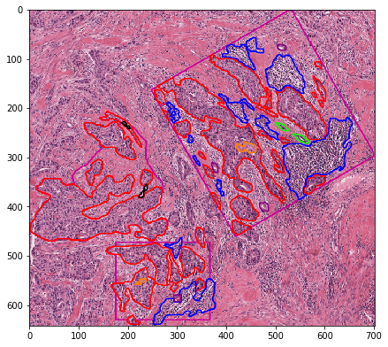 ../_images/examples_annotations_to_semantic_segmentation_masks_28_1.png