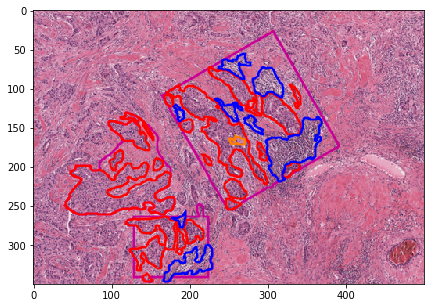 ../_images/examples_annotations_to_semantic_segmentation_masks_33_0.png